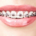 http://drashokdentistree.com/wp-content/uploads/2016/11/orthodontics-150x150.jpg