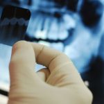 https://drashokdentistree.com/wp-content/uploads/2016/11/dental-radiography-150x150.jpg